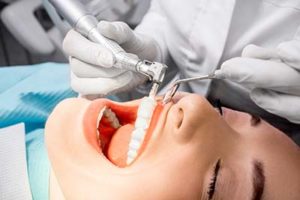 woman with open mouth being worked on by dentist, teeth cleaning conroe tx