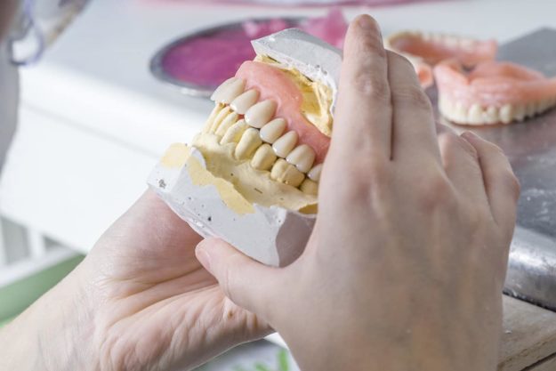 full dental implants looking at full dental implants
