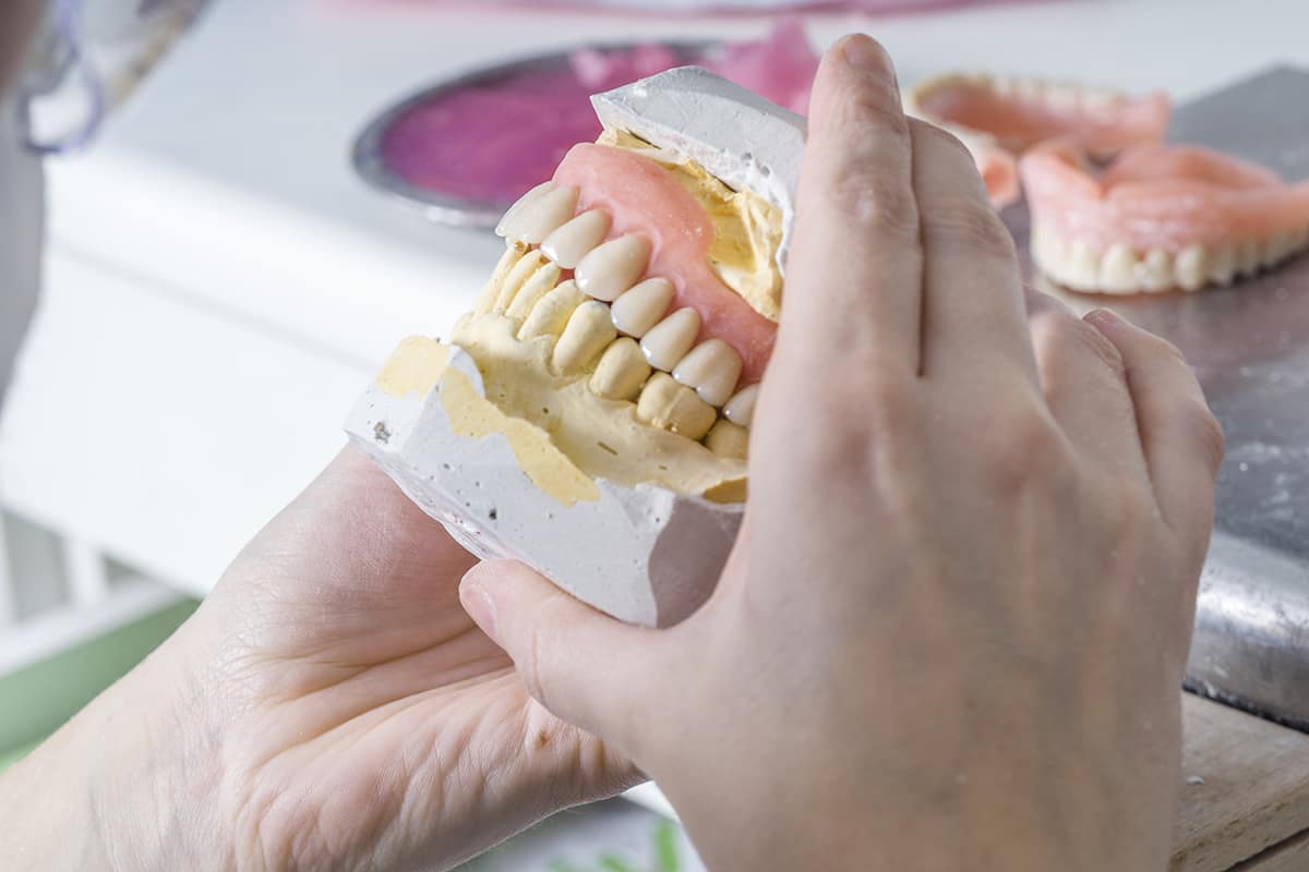 full dental implants looking at full dental implants