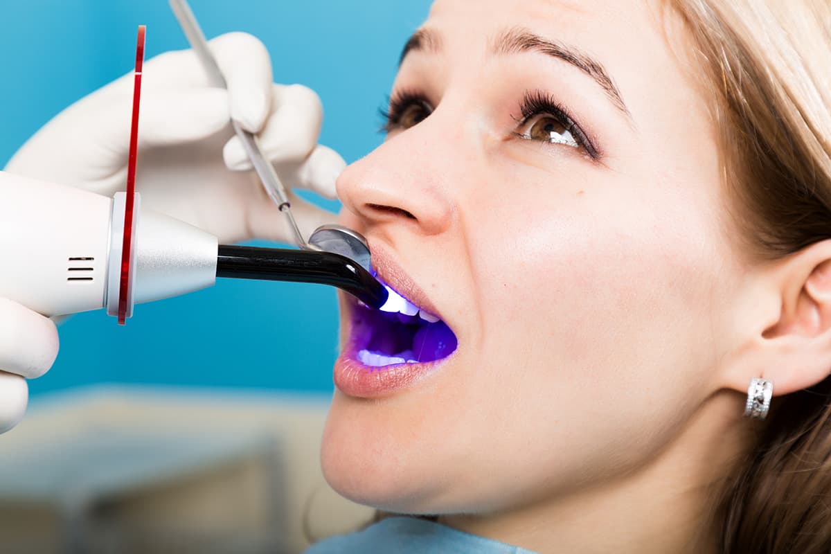 dental bonding patient getting dental bonding