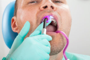 man receiving dental bonding treatment