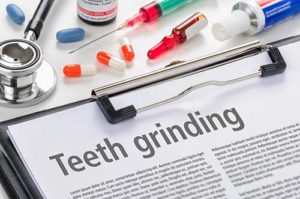 medical paper on teeth grinding