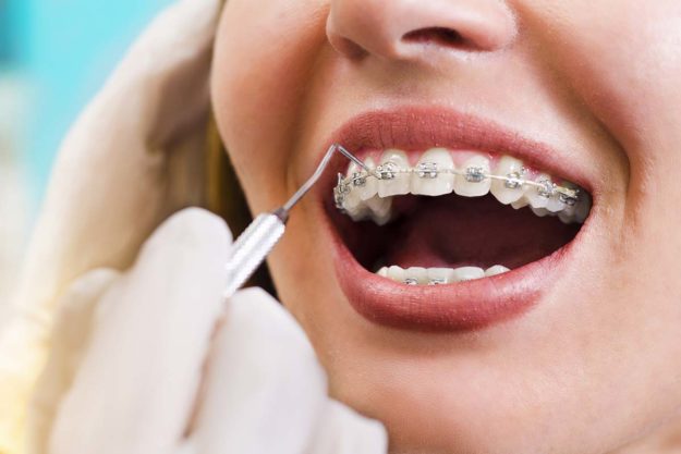 3 Benefits of Adult Orthodontic Services woman learning about adult orthodontics