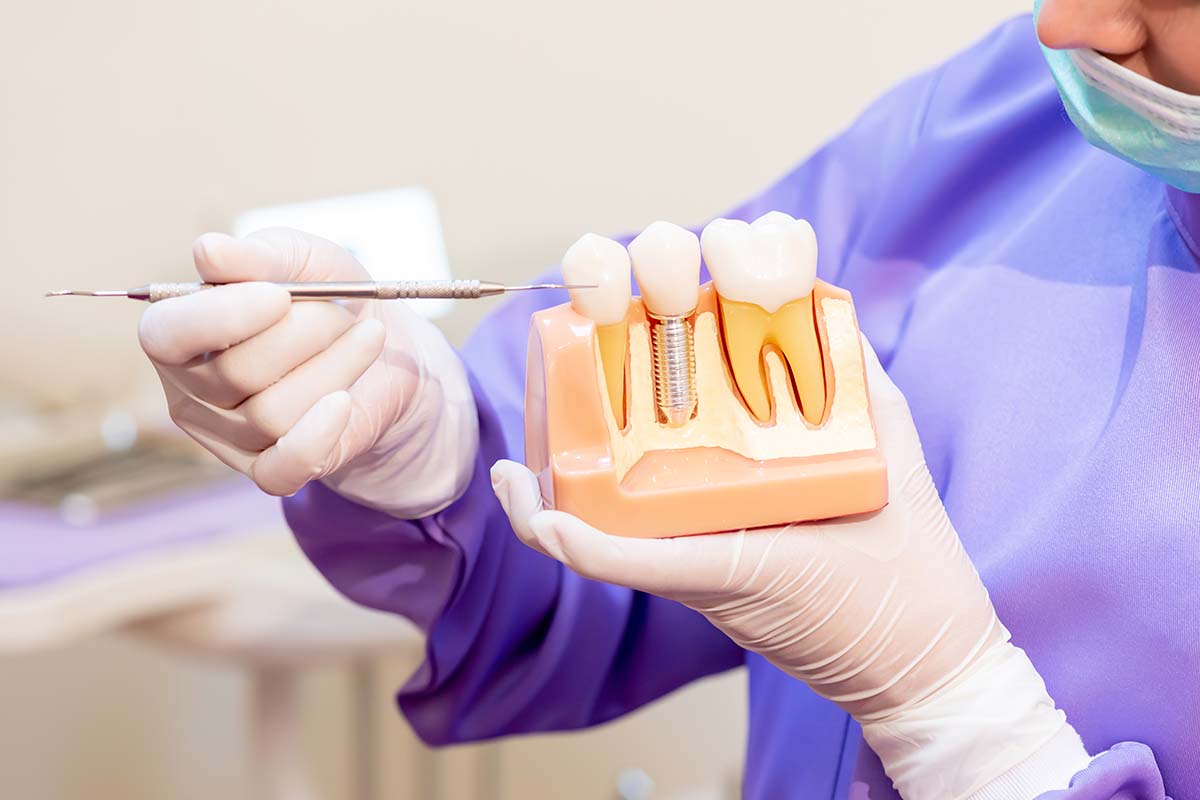 The Different Types of Dental Implants dentist explaining the different types of dental implants